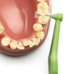 TePe International Brush Angle No.5 Πράσινο 0.8mm 6τμχ - Image 3