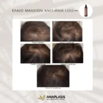 Anaplasis Έλαιο Μαλλιών RPNZL 100 ml - Image 3