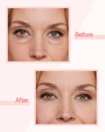 Remescar Eye Bags and Dark Circles 8mL - Image 2