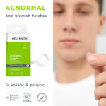 Helenvita ACNORMAL Anti -Blemish Patches - Image 3