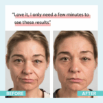 Remescar Instant Wrinkle Corrector Άμεση Διόρθωση των Ρυτίδων, 8mL - Image 2